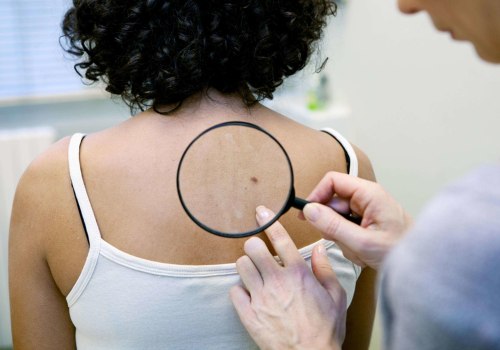 What happens if you don't file for medicare on time?